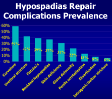 Hypospadias repair complications prevalence