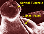 Image of hypospadias embryology genital tubercle